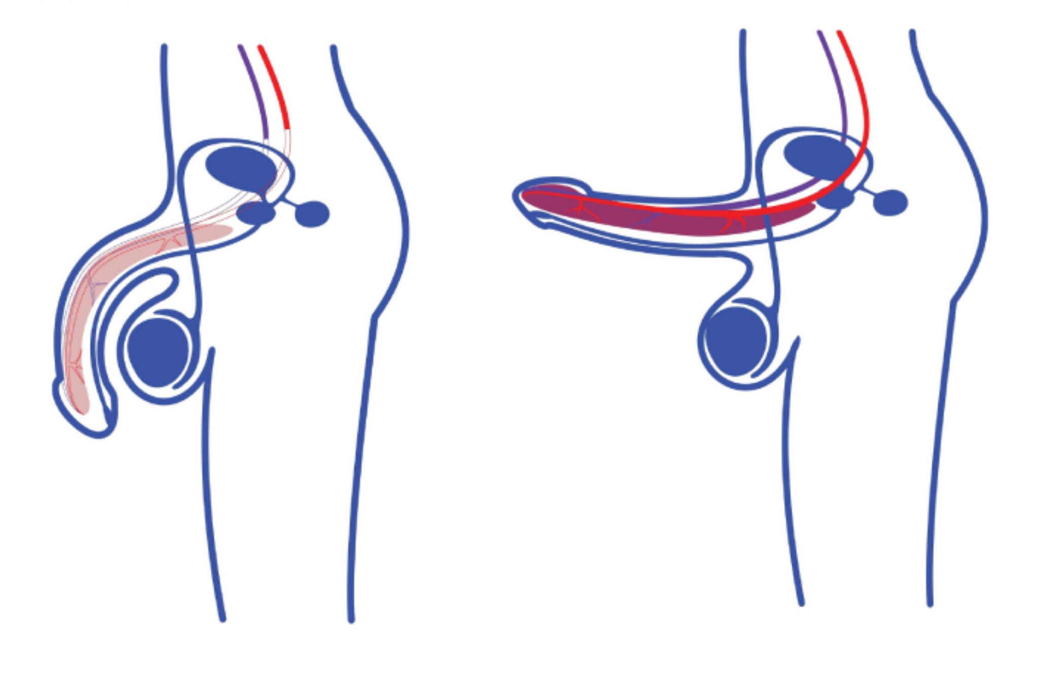 So- đo- qua- trinh-cuong- duong- binh- thuong- va- bat- thuong